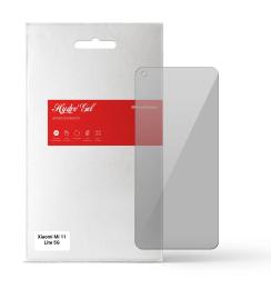 Захисна плівка ArmorStandart Anti-spy для Xiaomi Mi 11 Lite 5G Transparent гідрогелева