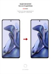 Захисна плівка ArmorStandart Anti-spy для Xiaomi 11T Transparent гідрогелева